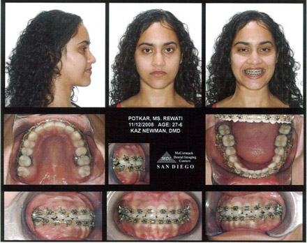 Smile Gallery Patient After