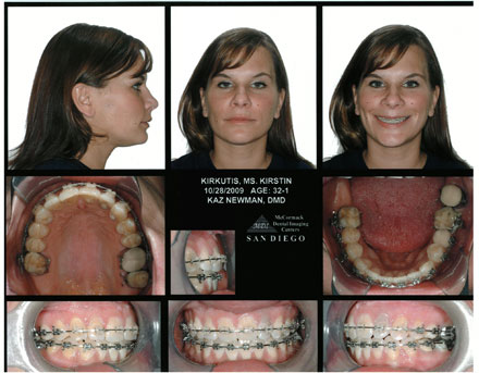 Smile Gallery Patient After