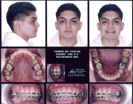 Smile Gallery Patient After