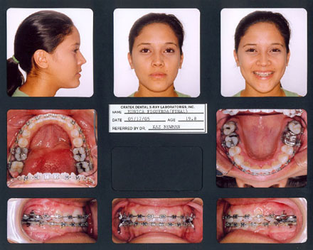 Smile Gallery Patient After