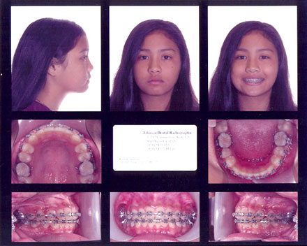 Smile Gallery Patient After