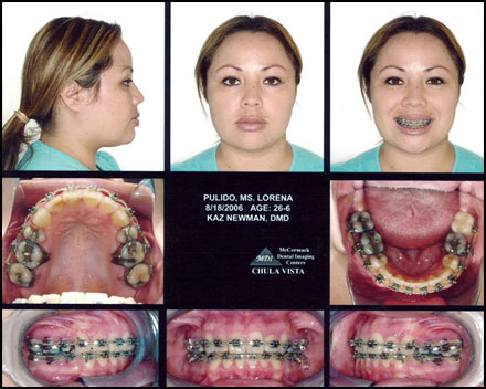 Smile Gallery Patient After