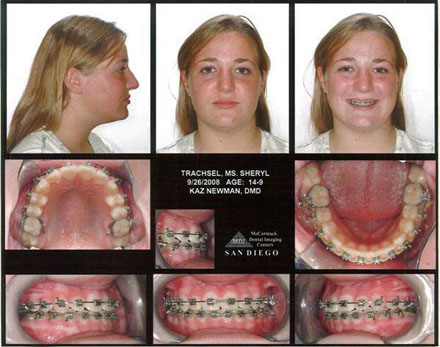 Smile Gallery Patient After